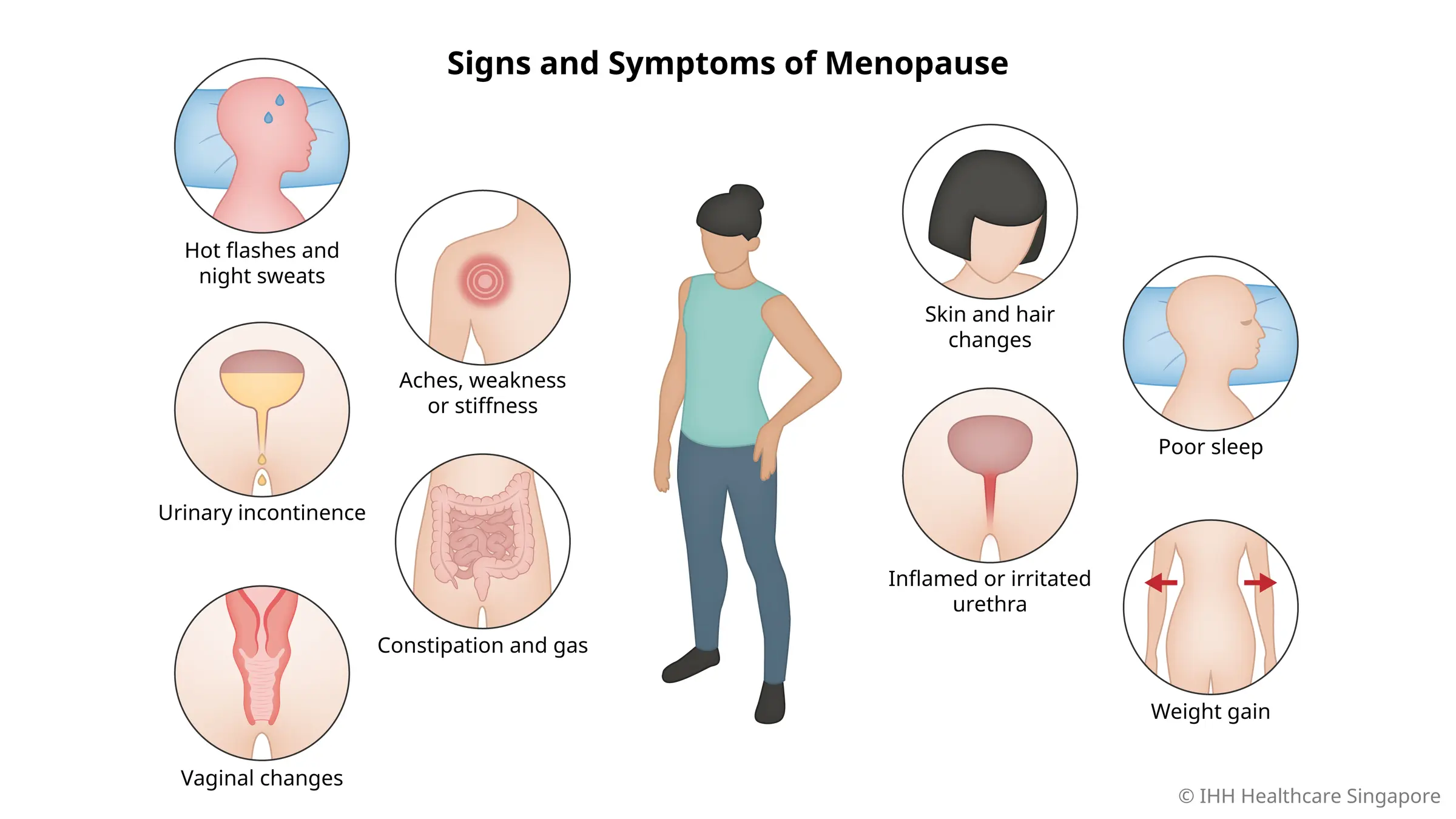 Understanding Meno Pause: Symptoms, Causes, and Treatment